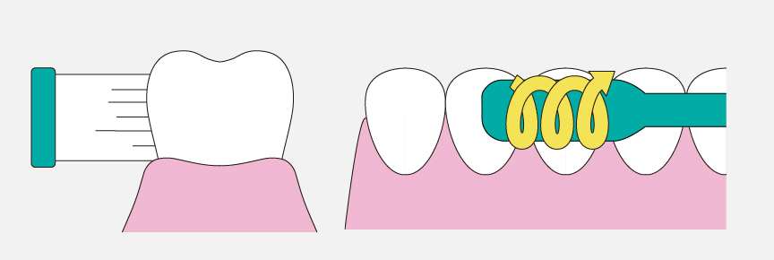 フォーンズ法の磨き方のイメージイラスト