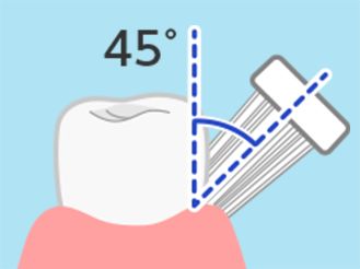歯と歯ぐきの境目 45°