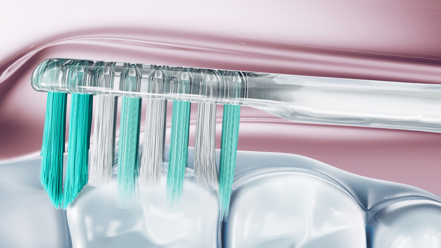 歯間にブラシが入り込む様子のイメージ