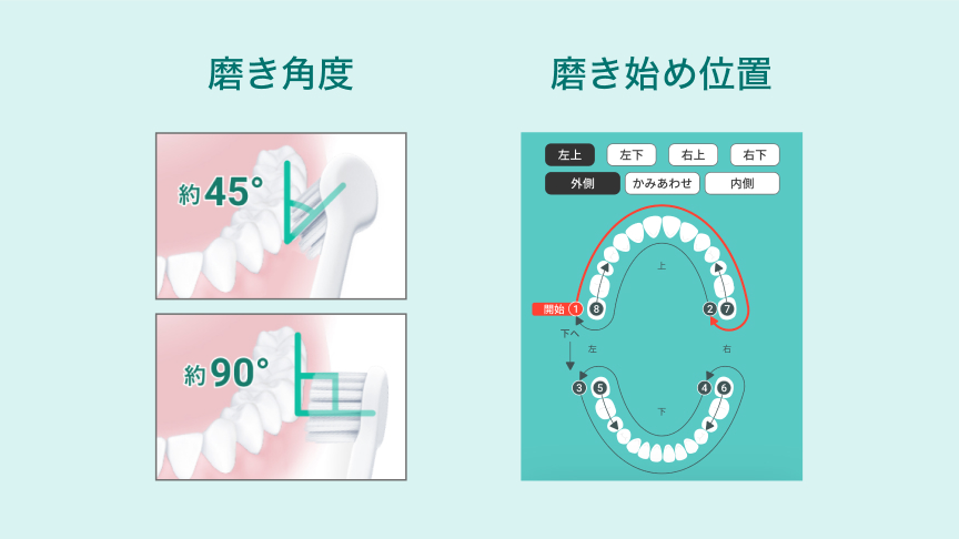 磨き角度 磨き始め位置