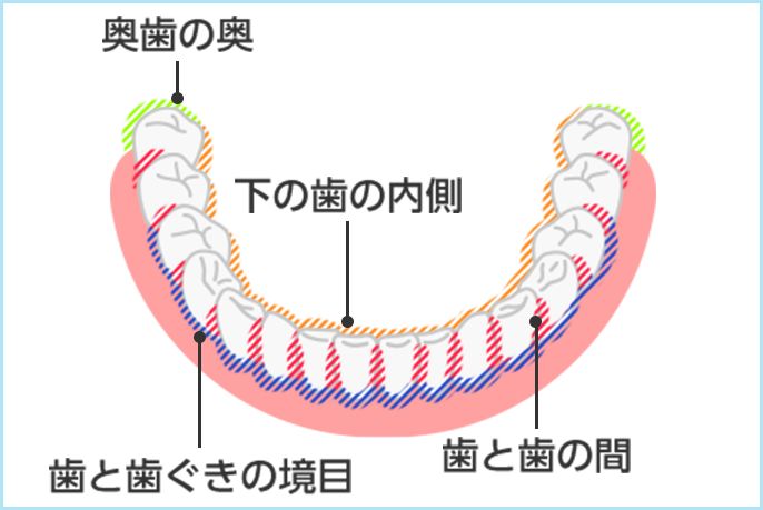 奥歯の奥/下の歯の内側/歯と歯ぐきの境目/歯と歯の間