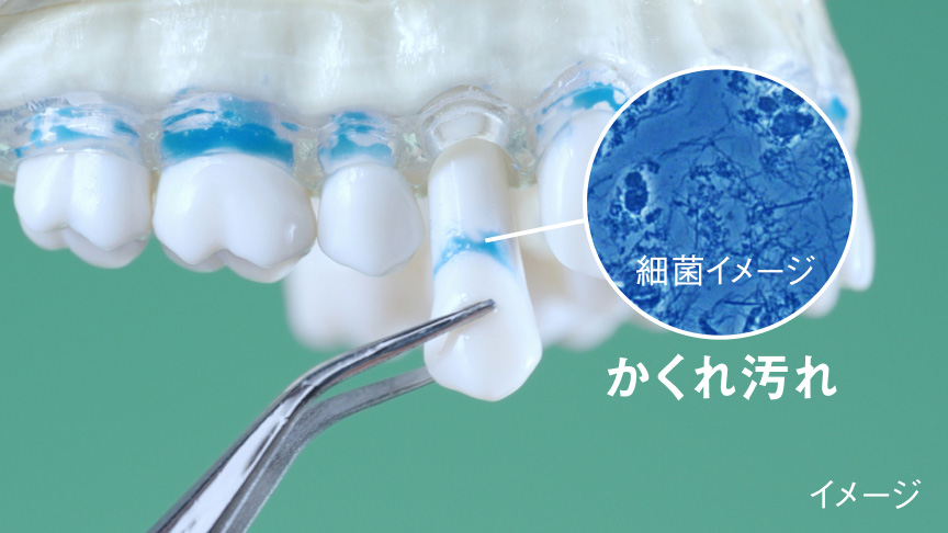 細菌イメージ かくれ汚れ イメージ