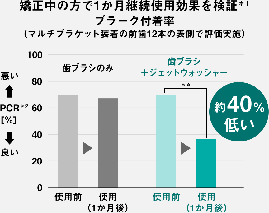 矯正中の方で1か月継続使用効果を検証*1 プラーク付着率（マルチブラケット装着の前歯12本の表側で評価実施） 悪い←PCR*2[%] 良い→歯ブラシのみ 使用前 使用（1か月後） 歯ブラシ＋ジェットウォッシャー 使用前 使用（1か月後）約40%低い