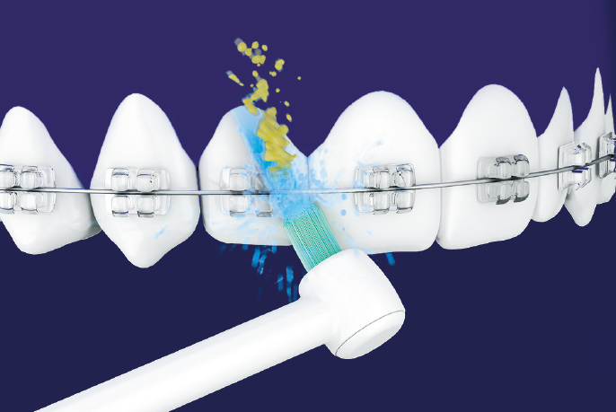 器具と歯の間の歯垢を除去するイメージ