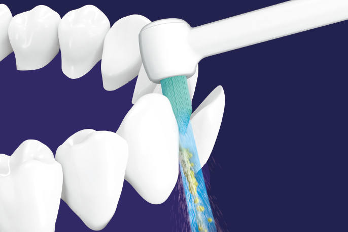 歯と歯の間の歯垢を除去するイメージ