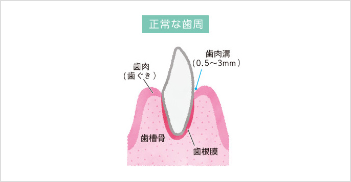正常な歯周のイメージ