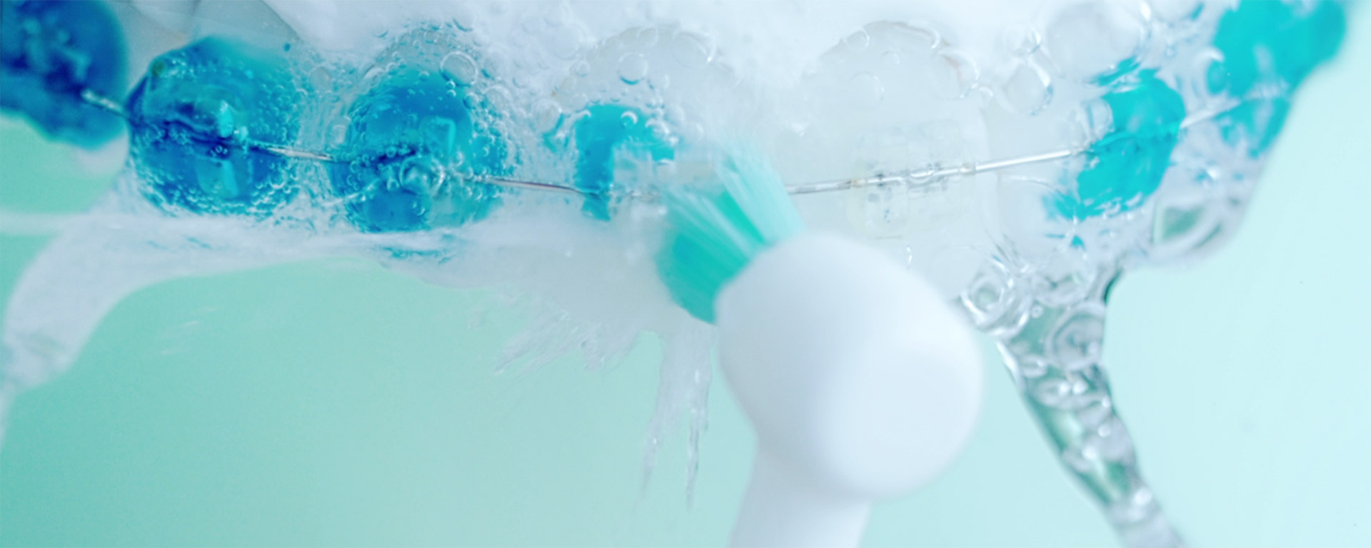 歯列矯正器具周りの汚れを磨いているイメージ