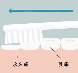 乳歯と比べてまだ高さが低い永久歯にブラシが届きにくい