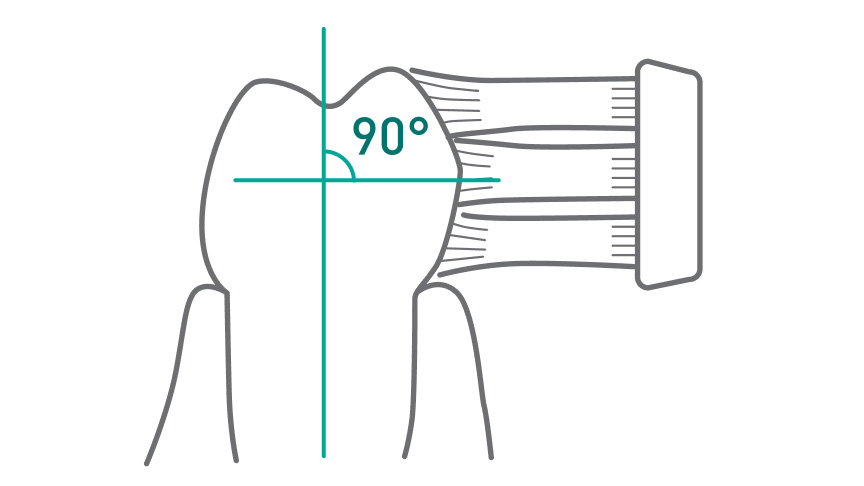 歯ブラシの毛先が歯の表面に対して垂直（90度）に当てられている様子を示す図