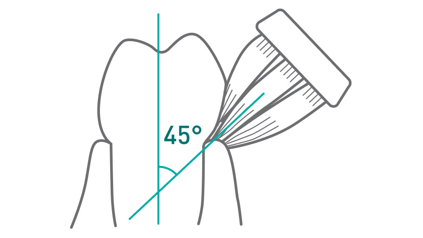 歯ブラシが歯と歯ぐきの境目に対して45度の角度で当てられている様子を示す図