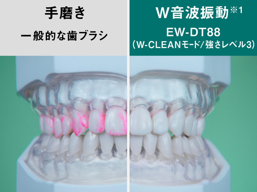 手磨きと電動歯ブラシの比較画像：手磨き 一般的な歯ブラシとW音波振動※1 EW-DT88(W-CLEANモード/強さレベル3)