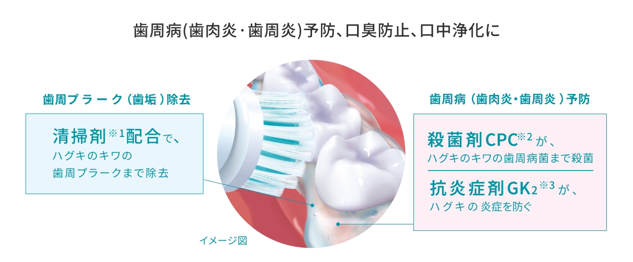 歯周病（歯肉炎・歯周炎）予防、口臭防止、口中浄化に 歯周プラーク（歯垢）除去 清掃剤※1配合で、ハグキのキワの歯周プラークまで除去 歯周病（歯肉炎・歯周炎）予防 殺菌剤CPC※2が、ハグキのキワの歯周病菌まで殺菌 抗炎症剤GK₂※3が、ハグキの炎症を防ぐ イメージ図