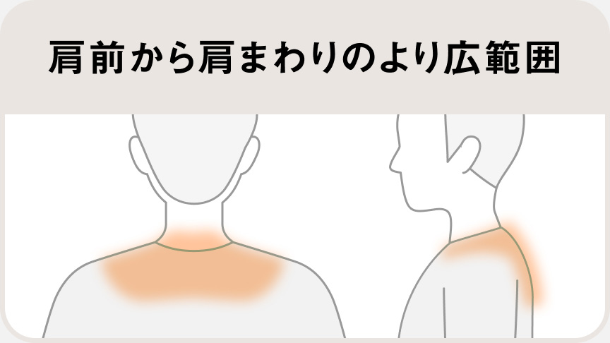 肩前から肩まわりのより広範囲