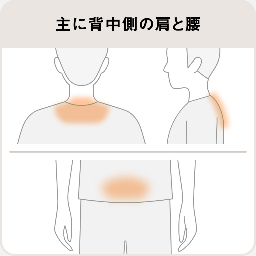 主に背中側の肩と腰