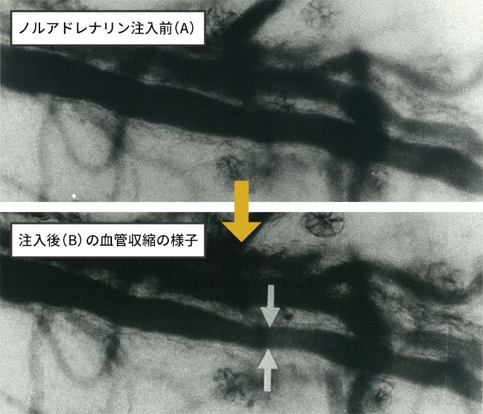 写真：ノルアドレナリン注入前（A）と注入後（B）の血管収縮の様子