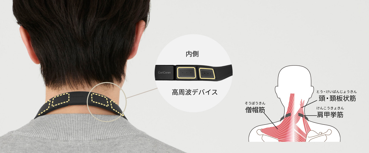 内側 高周波デバイス 僧帽筋 頭・頸板状筋 肩甲挙筋