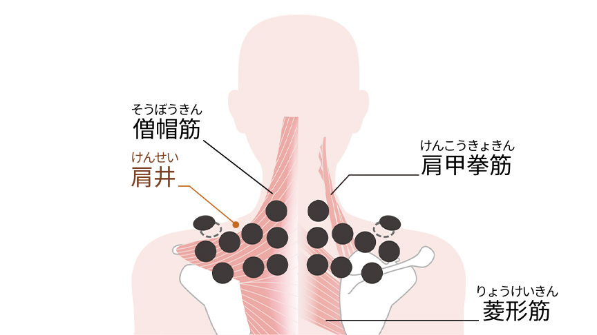 僧帽筋（そうぼうきん） 肩井（けんせい） 肩甲挙筋（けんこうきょきん） 菱形筋（りょうけいきん）