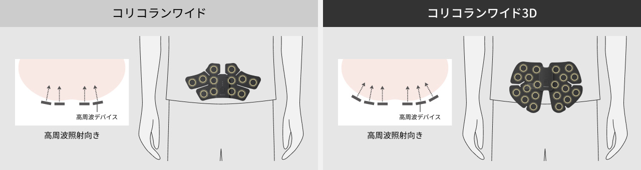 コリコランワイド 高周波デバイス 高周波照射向き コリコランワイド3D 高周波デバイス 高周波照射向き