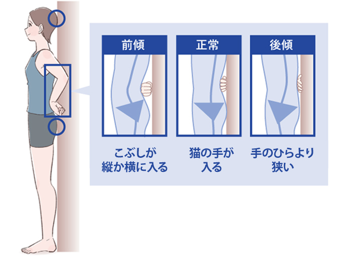 専門家監修 O脚が膝の痛みの原因に 原因や対策を解説 健康 Up Life 毎日を あなたらしく あたらしく Panasonic